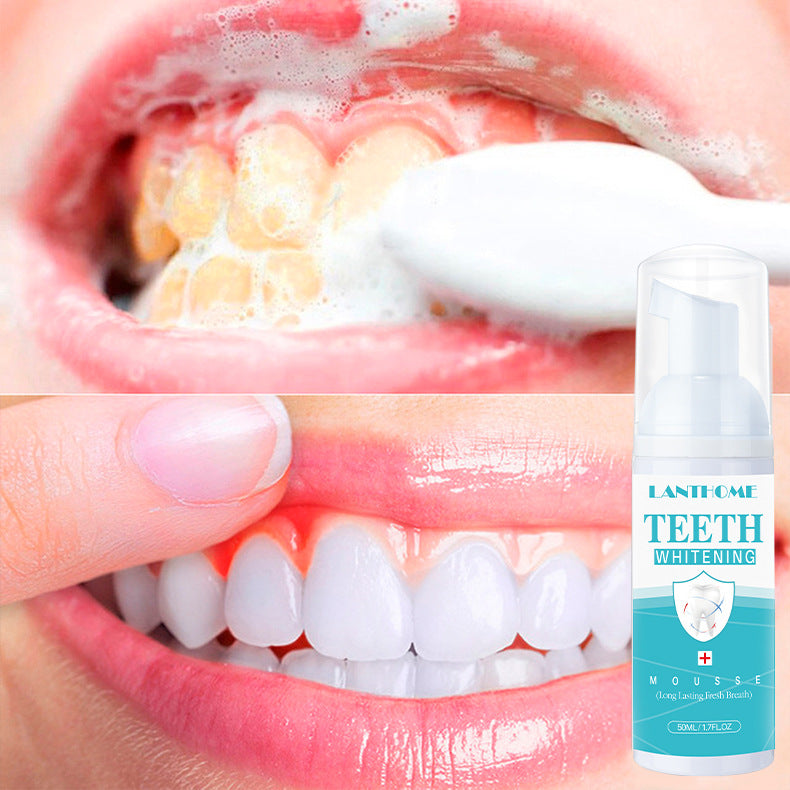 Sparkle White Teeth Mousse