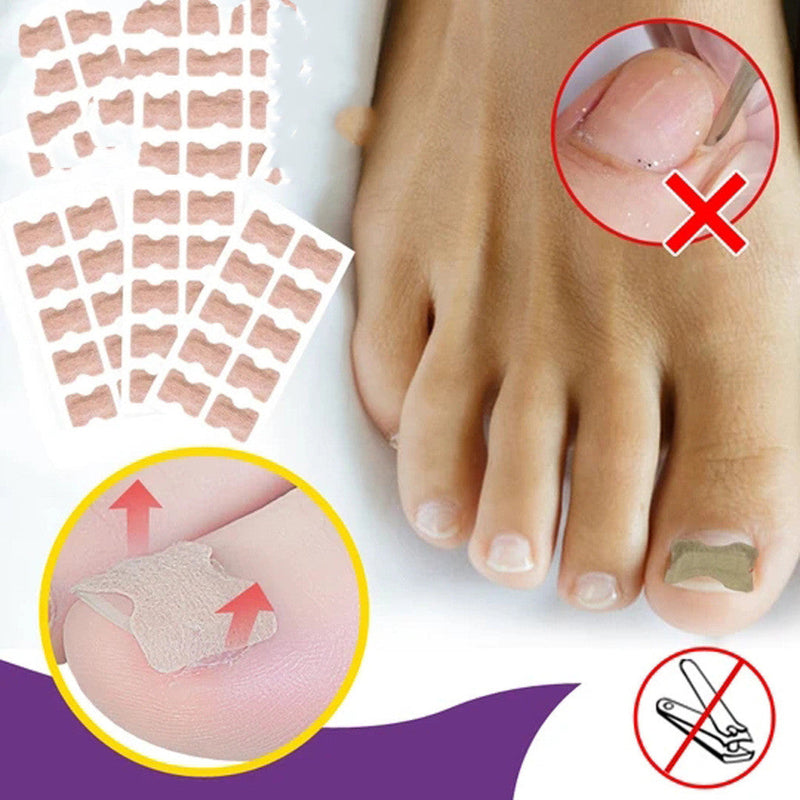 Toenail Correction Stickers