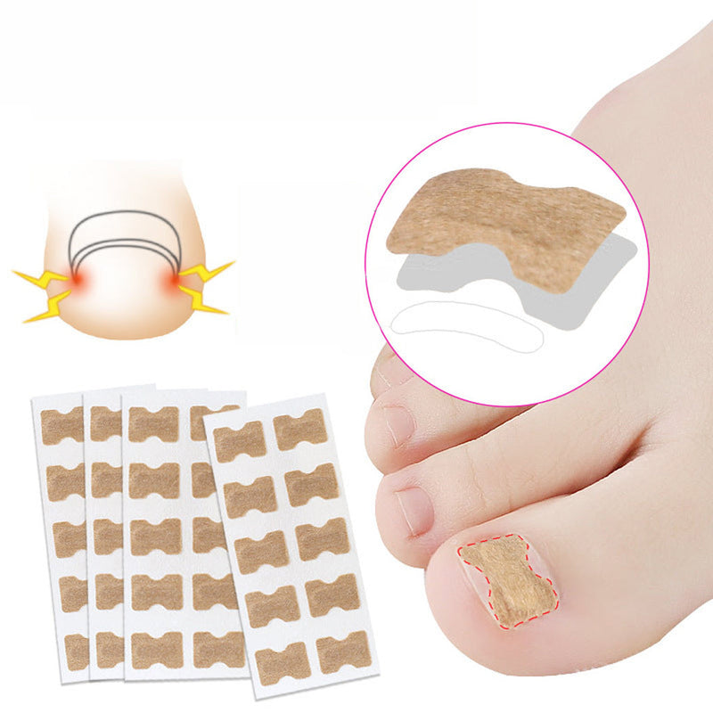 Toenail Correction Stickers