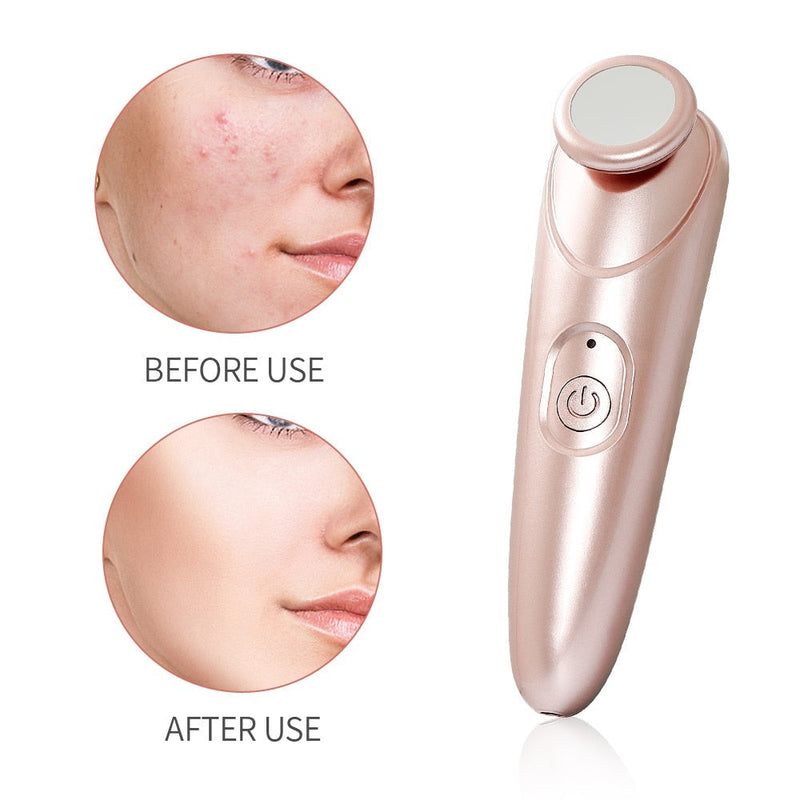 Ozone Acne Removal Plasma Pen