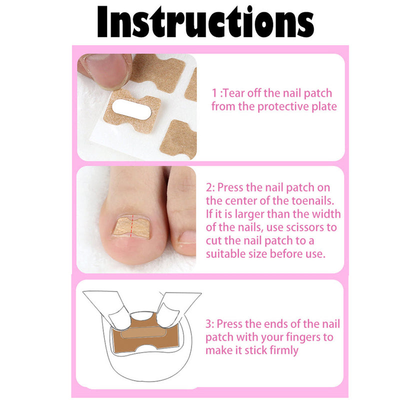 Toenail Correction Stickers